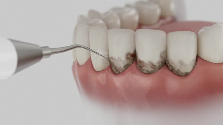 Reliable Invisalign Clear Aligners contractor in Pontotoc County County, MS by Dentist Open Now